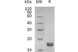 Western Blotting (WB) image for Interleukin 2 (IL2) (Active) protein (ABIN7320817) (IL-2 Protein)