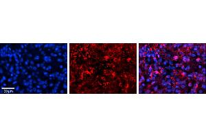 Rabbit Anti-GOT1 Antibody     Formalin Fixed Paraffin Embedded Tissue: Human Pineal Tissue  Observed Staining: Cytoplasmic in cell bodies and processes of pinealocytes  Primary Antibody Concentration: 1:100  Secondary Antibody: Donkey anti-Rabbit-Cy3  Secondary Antibody Concentration: 1:200  Magnification: 20X  Exposure Time: 0.