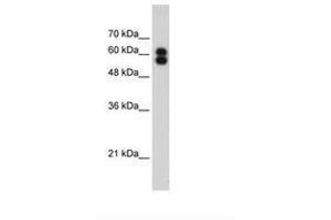 Image no. 2 for anti-Placental Alkaline Phosphatase (ALPP) (AA 411-460) antibody (ABIN203490) (PLAP antibody  (AA 411-460))