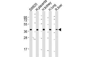 All lanes : Anti-B Antibody (N-term) at 1:2000 dilution Lane 1: S whole cell lysates Lane 2: human placenta lysates Lane 3: human kidney lysates Lane 4: human lung lysates Lane 5: rat liver lysates Lysates/proteins at 20 μg per lane.