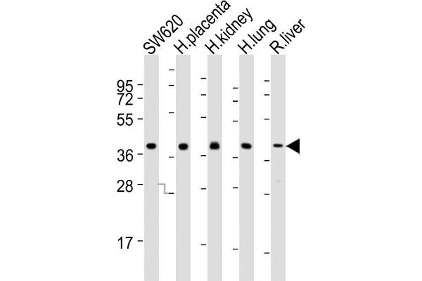 PPAP2B Antikörper  (N-Term)