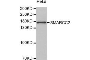 Western Blotting (WB) image for anti-SWI/SNF Related, Matrix Associated, Actin Dependent Regulator of Chromatin, Subfamily C, Member 2 (SMARCC2) (AA 150-250) antibody (ABIN3022693)