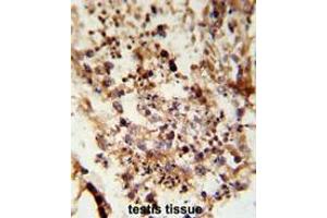 Formalin-fixed and paraffin-embedded human testis tissue reacted with ACR Antibody (C-term), which was peroxidase-conjugated to the secondary antibody, followed by DAB staining. (Acrosin antibody  (C-Term))