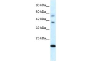 Western Blotting (WB) image for anti-BolA-like Protein 1 (BOLA1) antibody (ABIN2460373) (BOLA1 antibody)