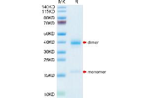 TTR Protein (AA 21-147) (His tag)