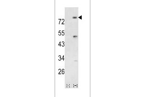 Western blot analysis of PIK3R5 (arrow) using rabbit polyclonal PIK3R5 Antibody (Center) (ABIN392579 and ABIN2842114).