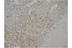 Immunohistochemistry (IHC) image for anti-alpha-Fetoprotein (AFP) antibody (ABIN1105327) (alpha Fetoprotein antibody)