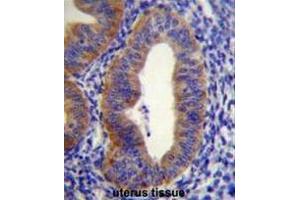 FGD6 Antibody (C-term) immunohistochemistry analysis in formalin fixed and paraffin embedded human uterus tissue followed by peroxidase conjugation of the secondary antibody and DAB staining. (FGD6 antibody  (C-Term))