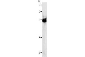 Western Blotting (WB) image for anti-Protein Kinase, CAMP-Dependent, Regulatory, Type I, beta (PRKAR1B) antibody (ABIN2426823)
