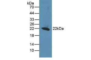 Figure. (REV1 antibody  (AA 301-478))