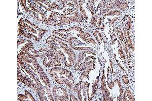 IHC analysis of HSPH1 using anti-HSPH1 antibody (ABIN7602237).
