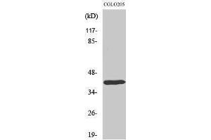 Western Blotting (WB) image for anti-Distal-Less Homeobox 4 (DLX4) (Internal Region) antibody (ABIN3184316) (DLX4 antibody  (Internal Region))