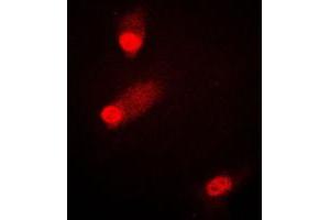 Immunofluorescent analysis of MKK4 (pS80) staining in HEK293T cells. (MAP2K4 antibody  (pSer80))