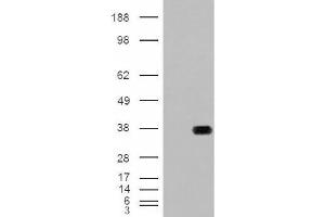 Image no. 2 for anti-Hydroxyacyl-CoA Dehydrogenase (HADH) (Internal Region) antibody (ABIN374901)