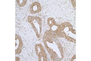Immunohistochemistry (IHC) image for anti-Aminoacyl tRNA Synthetase Complex-Interacting Multifunctional Protein 1 (AIMP1) (AA 262-312) antibody (ABIN7455058)