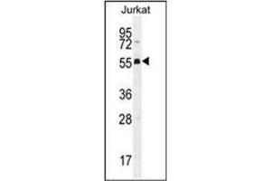 Western blot analysis of PODNL1 Antibody (Center) Cat. (PODNL1 antibody  (Middle Region))