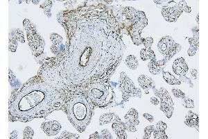 IHC analysis of Filamin B/FLNB using anti-Filamin B/FLNB antibody (ABIN7601607). (FLNB antibody  (AA 397-701))