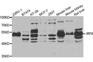 Western blot analysis of extracts of various cell lines, using IRF6 antibody. (IRF6 antibody)