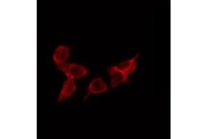 ABIN6275080 staining Hela by IF/ICC. (DNAJC5 antibody  (Internal Region))