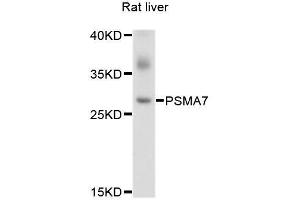 Western blot analysis of extracts of rat liver, using PSMA7 antibody. (PSMA7 antibody  (AA 1-248))