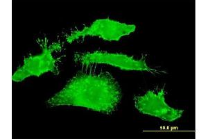 Immunofluorescence of monoclonal antibody to RDX on HeLa cell. (Radixin antibody  (AA 1-583))