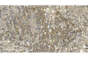 IHC analysis of RGS6 using anti-RGS6 antibody (ABIN7602326). (RGS6 antibody  (AA 7-357))