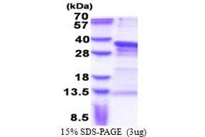 SDS-PAGE (SDS) image for Paired Related Homeobox 1 (PRRX1) (AA 1-217) protein (His tag) (ABIN5853292)