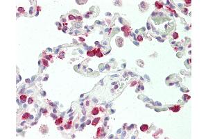 Anti-SFTPC / Surfactant Protein C antibody IHC staining of human lung. (Surfactant Protein C antibody  (AA 1-30))