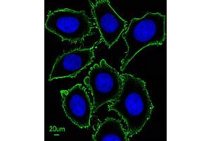 Immunofluorescent analysis of  cells, using KIT Antibody (ABIN1882197 and ABIN2843885). (KIT antibody)