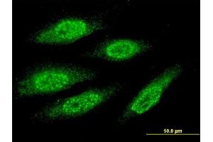 Immunofluorescence of monoclonal antibody to MAGEA8 on HeLa cell.