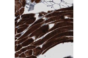 Immunohistochemical staining (Formalin-fixed paraffin-embedded sections) of human skeletal muscle with MYH6 monoclonal antibody, clone CL2148  shows strong cytoplasmic immunoreactivity in striated muscle fibers. (MYH6 antibody)