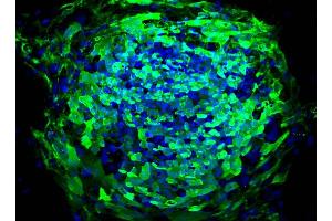 Immunofluorescent staining of human ES cell line (TRA1-81 antibody)