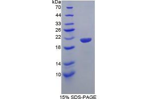 Image no. 1 for Helicase-Like Transcription Factor (HLTF) (AA 831-990) protein (His tag) (ABIN4989328) (HLTF Protein (AA 831-990) (His tag))