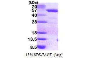 SDS-PAGE (SDS) image for Phosphate Cytidylyltransferase 2, Ethanolamine (PCYT2) (AA 1-389) protein (His tag) (ABIN667642)