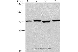 Western blot analysis of Human fetal liver and mouse stomach tissue, hela and hepG2 cell, using ARNTL Polyclonal Antibody at dilution of 1:450 (ARNTL antibody)