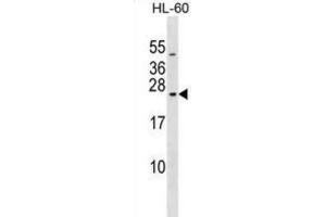 Western Blotting (WB) image for anti-RAB20, Member RAS Oncogene Family (RAB20) antibody (ABIN2999572) (RAB20 antibody)
