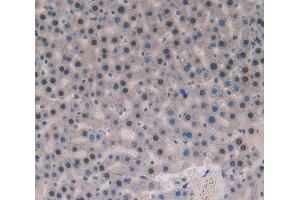 Used in DAB staining on fromalin fixed paraffin- embedded liver tissue (SOD4 antibody  (AA 27-268))