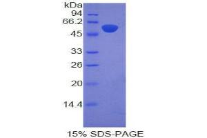SDS-PAGE (SDS) image for Proopiomelanocortin (POMC) (AA 27-235) protein (His tag,GST tag) (ABIN2123520)