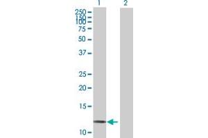 Western Blot analysis of LAMA4 expression in transfected 293T cell line by LAMA4 MaxPab polyclonal antibody. (LAMa4 antibody  (AA 1-120))