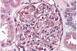 Human Kidney (formalin-fixed, paraffin-embedded) stained with SGK2 antibody ABIN410773 followed by biotinylated goat anti-rabbit IgG secondary antibody ABIN481713, alkaline phosphatase-streptavidin and chromogen. (SGK2 antibody  (Kinase Domain))