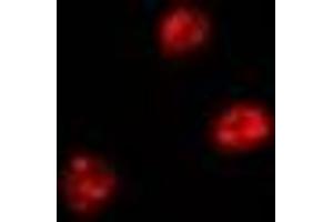 Immunofluorescent analysis of FIR staining in Hela cells. (FARP2 antibody)