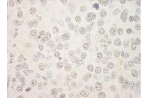 Immunohistochemistry (IHC) image for anti-Forkhead Box P1 (FOXP1) (AA 627-677) antibody (ABIN7448572)