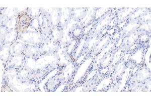 Detection of GAL1 in Bovine Kidney Tissue using Polyclonal Antibody to Galectin 1 (GAL1) (LGALS1/Galectin 1 antibody  (AA 1-135))