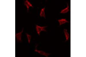 ABIN6269293 staining HeLa by IF/ICC. (RPS6 antibody  (C-Term))