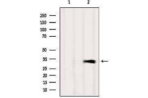 Western blot analysis of extracts from Mouse brain, using CAPZA1 Antibody. (CAPZA1 antibody  (Internal Region))