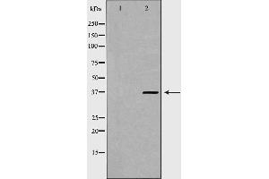 Western blot analysis of Hela whole cell lysates, using PSMD7 Antibody. (PSMD7 antibody  (C-Term))