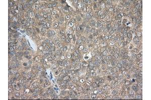 Immunohistochemical staining of paraffin-embedded Human colon tissue using anti-PDE4A mouse monoclonal antibody. (PDE4A antibody)