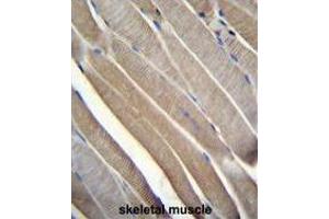 TRMT2B Antibody (N-term) immunohistochemistry analysis in formalin fixed and paraffin embedded human skeletal muscle followed by peroxidase conjugation of the secondary antibody and DAB staining. (TRMT2B antibody  (N-Term))
