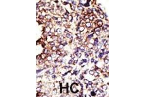 Immunohistochemistry (IHC) image for anti-Glucosaminyl (N-Acetyl) Transferase 1, Core 2 (GCNT1) antibody (ABIN3001515) (GCNT1 antibody)