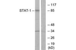 Western blot analysis of extracts from COLO205 cells, using STAT1 (Ab-701) Antibody. (STAT1 antibody  (AA 668-717))
